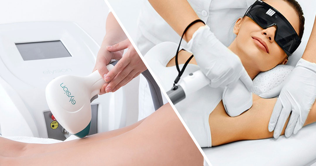 Laser Vs IPL Hair Removal Rachel Staggs Aesthetics